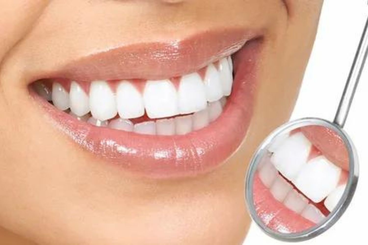 Dental Services- Teeth Whitening